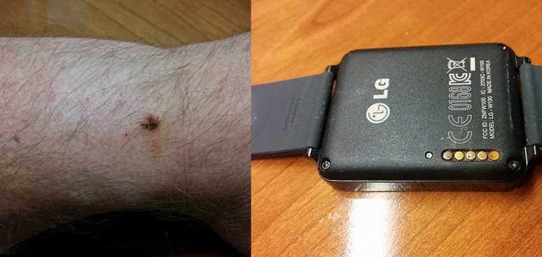 LG G Watch