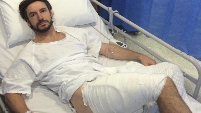 Australia, cade a terra e gli esplode l’iPhone in tasca